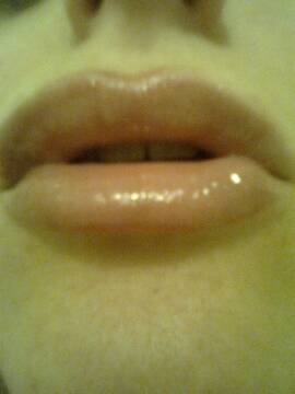 Public Photo of Stella-Argentata